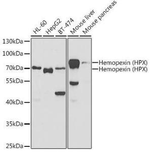 Western blot analysis of extracts of various cell lines, using Anti-Hemopexin Antibody (A11850) at 1:1,000 dilution