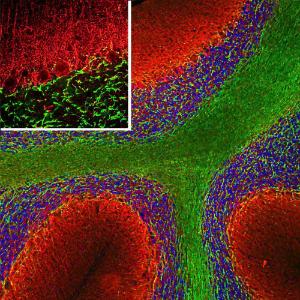 Anti-alpha Internexin antibody