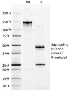 SDS-PAGE analysis of Anti-CD2 Antibody [1E7E8.G4] under non-reduced and reduced conditions; showing intact IgG and intact heavy and light chains, respectively. SDS-PAGE analysis confirms the integrity and purity of the antibody