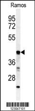 Anti-B3GALT6 Rabbit Polyclonal Antibody