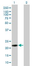 Anti-BLOC1S5 Mouse Polyclonal Antibody