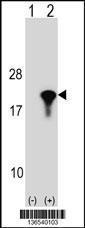 Anti-PPIL1 Rabbit Polyclonal Antibody (APC (Allophycocyanin))