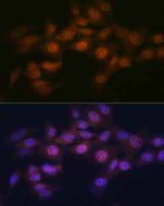 Immunofluorescence analysis of NIH-3T3 cells using Anti-WAPL/FOE Antibody [ARC2088] (A307938) at a dilution of 1:100 (40X lens). DAPI was used to stain the cell nuclei (blue)