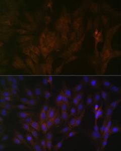 Immunofluorescence analysis of C6 cells using Anti-15-PGDH Antibody [ARC1280] (A305556) at a dilution of 1:100 (40x lens). DAPI was used to stain the cell nuclei (blue)