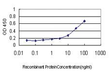 Anti-ARX Mouse Monoclonal Antibody [clone: 1G2]