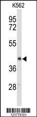 Anti-ENTPD2 Rabbit Polyclonal Antibody (AP (Alkaline Phosphatase))