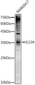 Western blot analysis of extracts of RAW264. 7 cells, using Anti-IL-12A Antibody (A306535) at 1:1000 dilution. The secondary Antibody was Goat Anti-Rabbit IgG H&L Antibody (HRP) at 1:10000 dilution. Lysates/proteins were present at 25 µg per lane