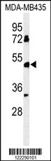 Anti-BTNL8 Rabbit Polyclonal Antibody