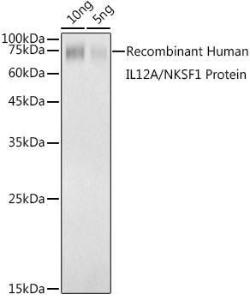 Western blot analysis of extracts of Recombinant Human IL12A/NKSF1 Protein, using Anti-IL-12A Antibody (A306535) at 1:1000 dilution. The secondary Antibody was Goat Anti-Rabbit IgG H&L Antibody (HRP) at 1:10000 dilution.