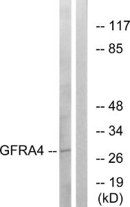 Western blot analysis of lysates from HeLa cells using Anti-GFRA4 Antibody. The right hand lane represents a negative control, where the antibody is blocked by the immunising peptide.