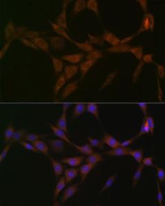 Immunofluorescence analysis of NIH-3T3 cells using Anti-15-PGDH Antibody [ARC1280] (A305556) at a dilution of 1:100 (40x lens). DAPI was used to stain the cell nuclei (blue)