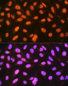 Immunofluorescence analysis of U-2 OS cells using Anti-hnRNP C1/C2/HNRNPC Antibody [ARC1366] (A306536) at a dilution of 1:100 (40X lens). DAPI was used to stain the cell nuclei (blue)