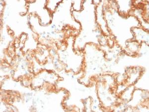 Immunohistochemical analysis of formalin-fixed, paraffin-embedded human lung using Anti-CD29 Antibody [ITGB1/3613]