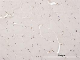 Anti-ARX Mouse Monoclonal Antibody [clone: 4H8]