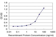 Anti-ARX Mouse Monoclonal Antibody [clone: 4H8]