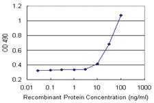 Anti-DHRS9 Polyclonal Antibody Pair