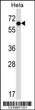 Anti-NR0B1 Rabbit Polyclonal Antibody (FITC (Fluorescein Isothiocyanate))