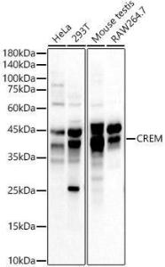 Anti-ICER antibody