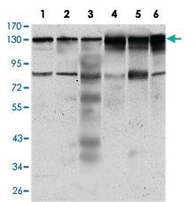 Anti-PTK7 Mouse Monoclonal Antibody [clone: 4F9]