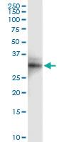 Anti-PMM2 Polyclonal Antibody Pair