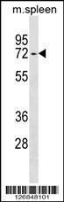 Anti-ENTPD4 Rabbit Polyclonal Antibody (Biotin)