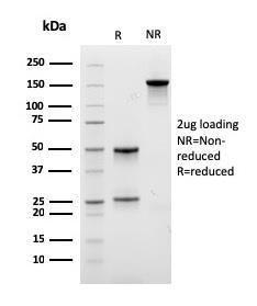 SDS-PAGE analysis of Anti-CD29 Antibody [ITGB1/3613] under non-reduced and reduced conditions; showing intact IgG and intact heavy and light chains, respectively. SDS-PAGE analysis confirms the integrity and purity of the antibody.