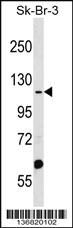 Anti-MTMR4 Rabbit Polyclonal Antibody