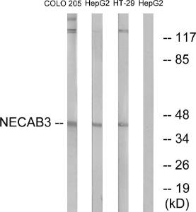 Anti-Neuronal calcium-binding protein Rabbit Polyclonal Antibody