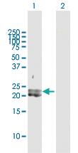 Anti-PDGFA Rabbit Polyclonal Antibody