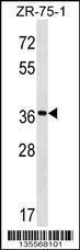 Anti-FUT7 Rabbit Polyclonal Antibody (AP (Alkaline Phosphatase))