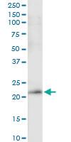 Anti-PDGFA Rabbit Polyclonal Antibody