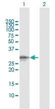 Anti-CELA3A Rabbit Polyclonal Antibody