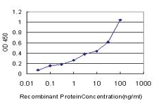 Anti-EXOC7 Mouse Monoclonal Antibody [clone: 1D4]