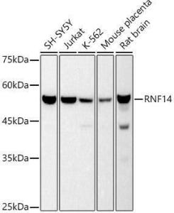 Western blot analysis of extracts of various cell lines, using Anti-RNF14 Antibody [ARC2884] (A306540) at 1:500 dilution