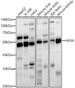 Western blot analysis of extracts of various cell lines, using Anti-HEXA Antibody (A11857) at 1:1000 dilution. The secondary Antibody was Goat Anti-Rabbit IgG H&L Antibody (HRP) at 1:10000 dilution. Lysates/proteins were present at 25 µg per lane