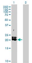 Anti-PDGFA Rabbit Polyclonal Antibody