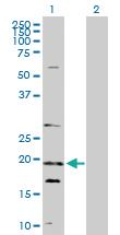 Anti-NUDT10 Rabbit Polyclonal Antibody