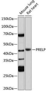 Western blot analysis of extracts of various cell lines, using Anti-PRELP Antibody (A306541) at 1:1,000 dilution. The secondary antibody was Goat Anti-Rabbit IgG H&L Antibody (HRP) at 1:10,000 dilution.