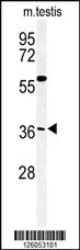 Anti-CCD92 Rabbit Polyclonal Antibody