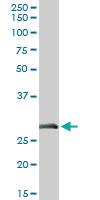 Anti-CELA3A Rabbit Polyclonal Antibody