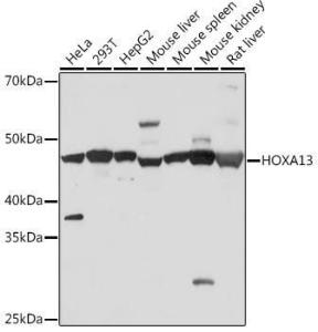 Western blot analysis of extracts of various cell lines, using Anti-HOXA13 Antibody [ARC1636] (A306542) at 1:500 dilution. The secondary antibody was Goat Anti-Rabbit IgG H&L Antibody (HRP) at 1:10,000 dilution.