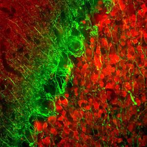 Antibody anti-alpha internexin 1D2 250 µl