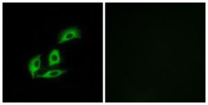 Anti-Neuronal calcium-binding protein Rabbit Polyclonal Antibody