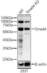 Western blot analysis of extracts from wild type(WT) and Smad4 Rabbit polyclonal antibody knockdown (KD) 293T cells, using Anti-Smad4 Antibody (A305558) at 1:600 dilution