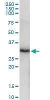 Anti-CELA3A Rabbit Polyclonal Antibody