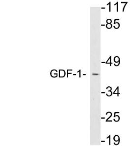 Western blot analysis of lysates from brain tissue using Anti-GDF-1 Antibody