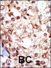 Anti-FGR Rabbit Polyclonal Antibody (AP (Alkaline Phosphatase))