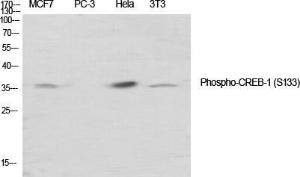 Immunohistochemical analysis of paraffin-embedded human uterus tissue using Anti-CREB (phospho Ser133) Antibody at 1:200 (4°C overnight). Negative control was secondary antibody only