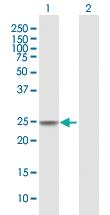 Anti-CIDEC Mouse Polyclonal Antibody