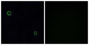 Anti-CXCR4 antibody